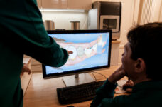 Come avviene la riabilitazione implantare?